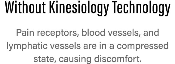 Without Kinesiology Technology Pain receptors, blood vessels, and  lymphatic vessels are in a  compressed state, caus   