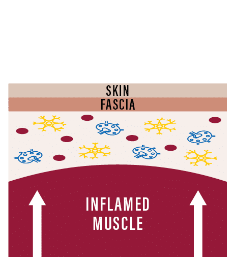 Without-Kinesiology-Cross-Section