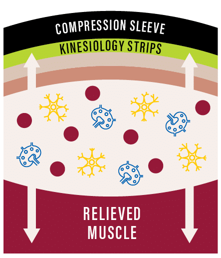 With-Kinesiology-Cross-Section