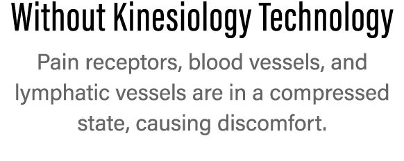 Without Kinesiology Technology Pain receptors, blood vessels, and  lymphatic vessels are in a  compressed state, caus   